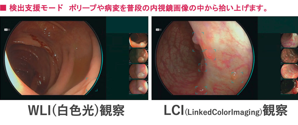 検出支援モード