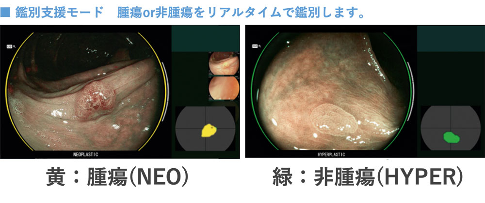 鑑別支援モード