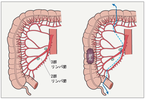 腸