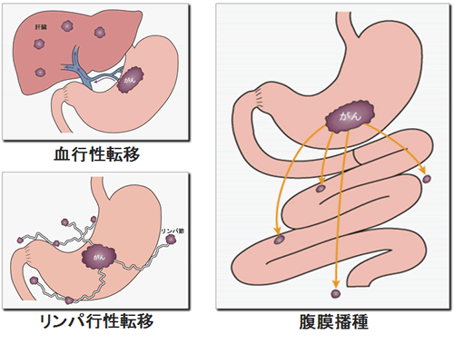 胃