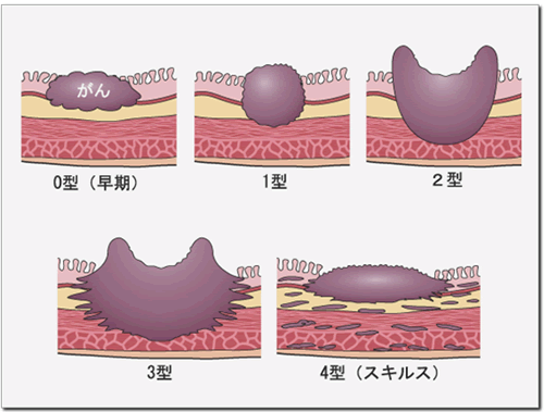 胃