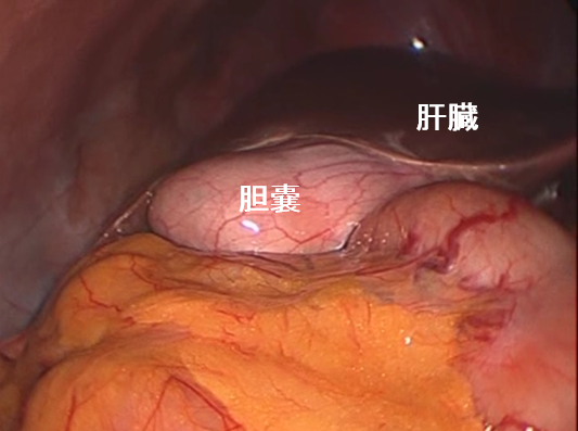 胆嚢は肝臓の下にくっついています。。